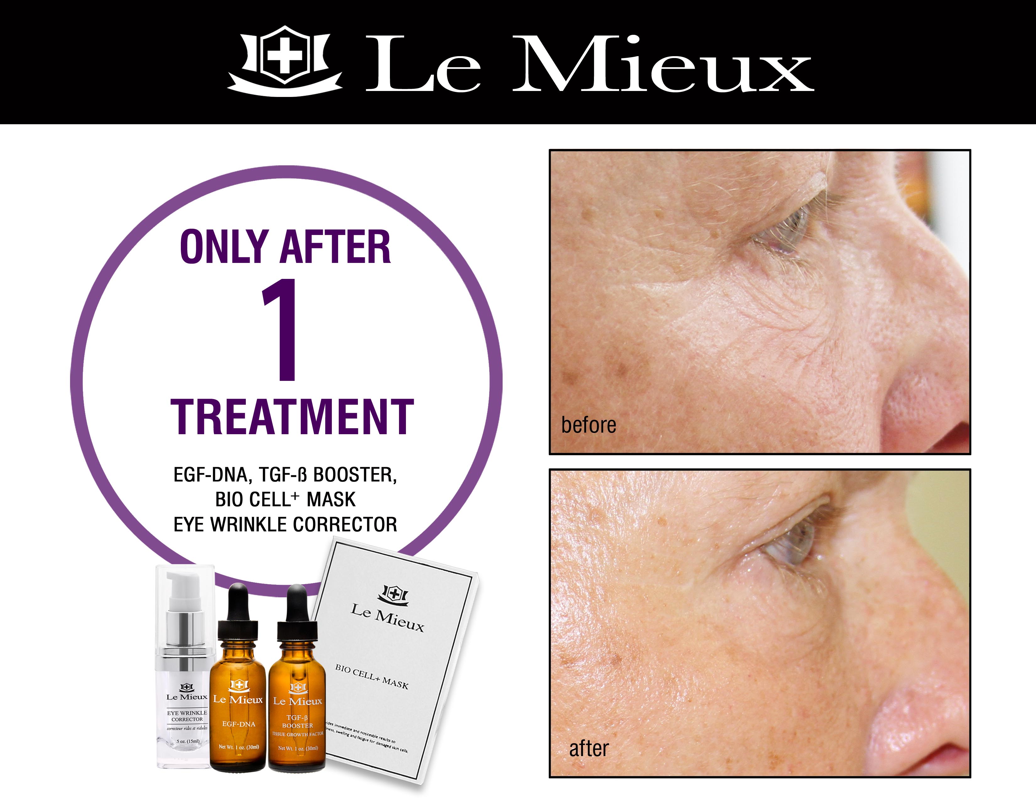 Anti-Aging-Eye-Karen-2